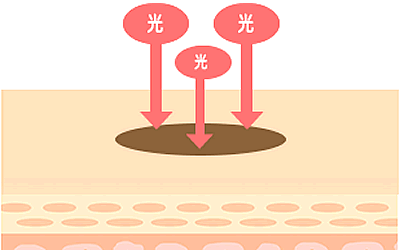 施術の流れ2